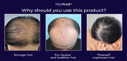 FEG Plus Hair Growth Spray